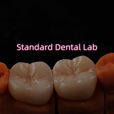 Full Contour Bruxier Monolit Zirkonia Crown Bridge Diş Laboratuarı