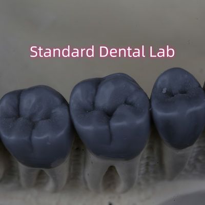 Profesyonel Dijital Diş Laboratuvarı 3 şekil diş balığı FDA tarafından onaylandı.