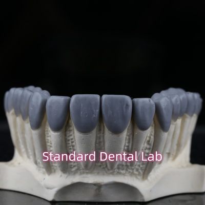 Standart Diş Laboratuvarı Diş Tacı Balmumu Yüksek Estetik
