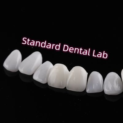 Sıvışmaya dayanıklı Emax Zirkonya Laminat Finerler Kesme Şeffaflığı