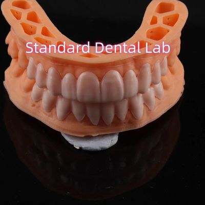 OEM ODM Pop On Veneers Özel Yapılmış Veneers Snap On Smile