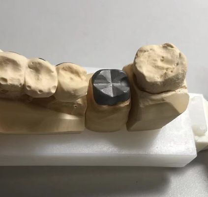 ISO FDA CE Dental Metal Post And Core Crown PFM İyi Uyumlu