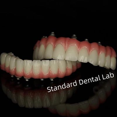 Standart Diş Laboratuvarı'ndan Dental Restorasyonlar