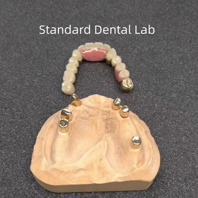 CAD CAM Diş Kısmi Diş Diş Ekimi Diş Hekimi Kesin