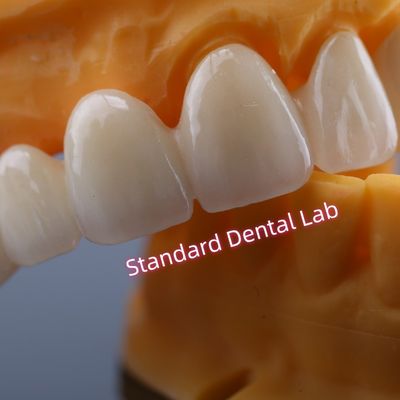 CAD CAM Mill Zirkonya Taç Köprüsü Yüksek Biyo Uyumlu