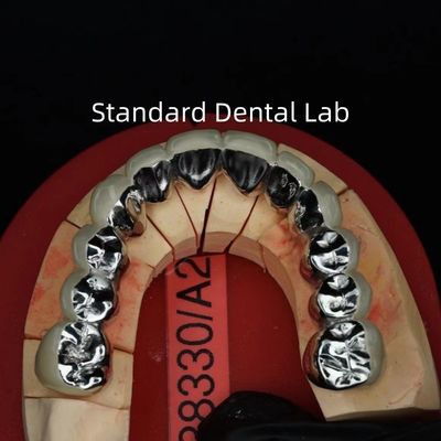 Full Arch Metal Porselen Taçlar / Köprü Precise Estetik PFM Taç Dental