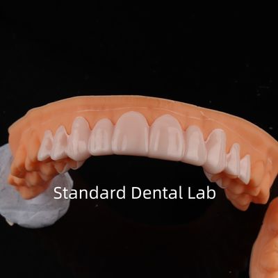 Yüksek Estetik Diş Hekimliği Smile Standart Diş Laboratuvarı