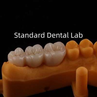 Be Ni Free Metal Porselen Taçları Precise Esthetic PFM Taç Dental