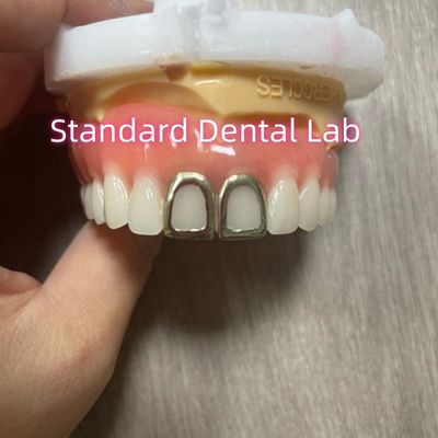 ISO Sarı Altın Dişli Tam Akrilik Diş Dişleri Açık Yüz