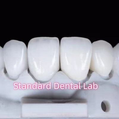 Doğal görünümlü restorasyonlar Aidite Dental Zirconia Diş Tacı