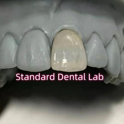 Restoratif Diş Hekimliği Emax Diş Zirkonya Porselen Taçları