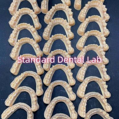 Profesyonel Diş Hekimi Ortodontik Invisalign Açık Tutsaklar Tedavi Planı