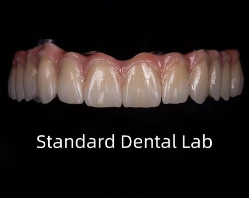 Titanyum tam zirkonya köprüsü implant çubuğunda diş şeffaflığı