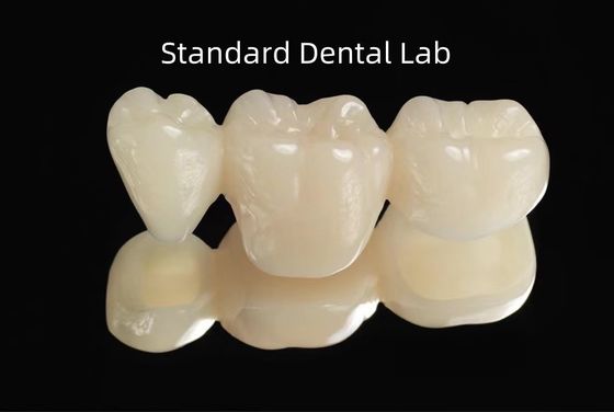 CAD CAM Boş PMMA Geçici Dental Geçici Köprü