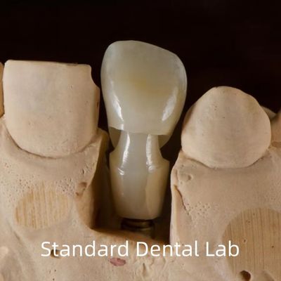 Diş İmplantı Tibase Zirkonya Abutment Titanyum Kesinlik Özel