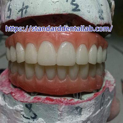 Diş implantı geçici taç pembe porselenli PMMA köprüsü
