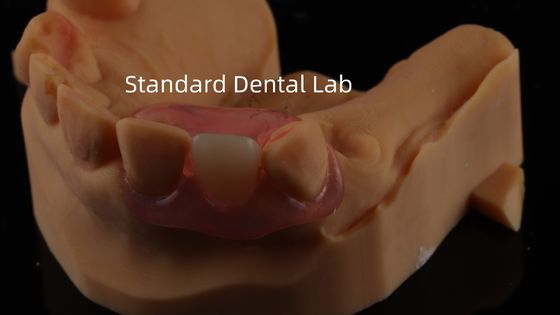 Diş TCS Valplast Esnek Kısmi Diş Dişleri Nesbit Valplast Finish Çin Diş Laboratuvarı Valplast Clap