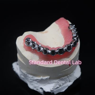 Dental Restorasyon Zirkonya Taçları Sakızlı Poecelian Çin Diş Laboratuarı