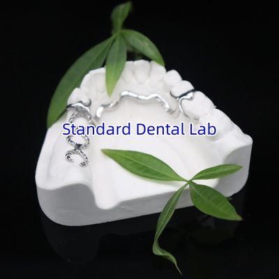 Vitallium 2000 kısmi çerçeve ISO CE ve FDA Çin diş laboratuvarı metal çerçeve