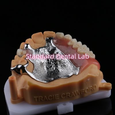 Yukarı dökme çerçeve Akrilik metal kısmi dişler Güçlü hafif ve dayanıklı