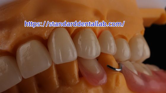 Katmanlı Diş Zirkonya Tacı ve Köprüsü Şeffaflık 3D PRO zirkonya porselen tacı Standart Diş Laboratuarı