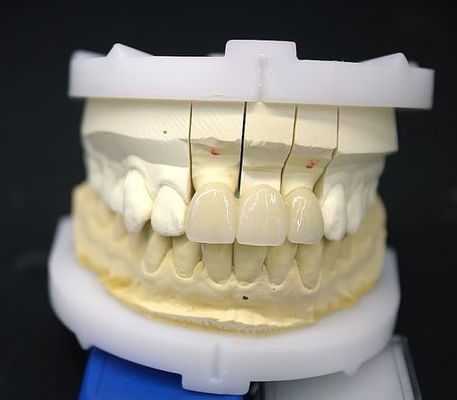 Kesin Zirconia Taç Köprüsü Rahat Uyum / Estetik 3-4 Gün Hızlı dönüş süresi
