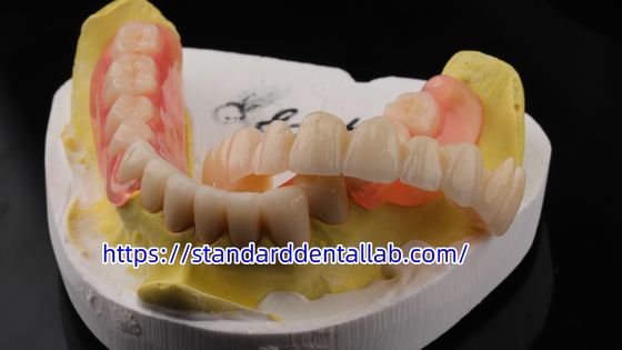 Yüksek Estetik Diş TCS Valplast Esnek Kısmi Diş Dişleri Diş Laboratuvarı Valplast Kısayol pembe renk