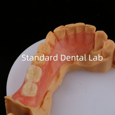 Ace Dişler Pembe/Koyu TCS Valplast Yüksek Estetik için Esnek Kısmi Diş Dişleri Diş 3D Baskı Modeli