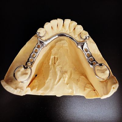 Hızlı ve dökme çerçeve diş hekimleri için Co-Cr metal kısmi diş protezi çerçevesi