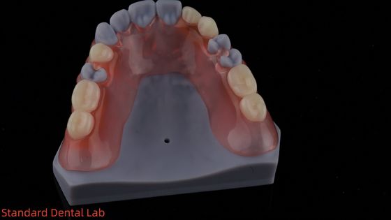 3D Baskı Modeli Yüksek Estetik Diş TCS Valplast Esnek Kısmi Diş Dişleri Diş Laboratuvarı