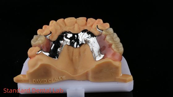 CorCr Metal Kısmi Diş Dişleri Yüksek Hafif Berilyum Serbest Ivoclar Scheftner Rahat Metal Çerçeve