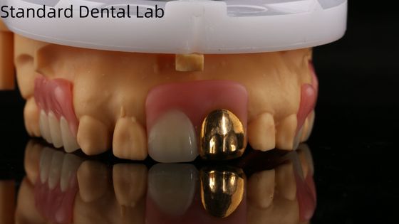 Sarı Altın Dişli Tam Akrilik Diş Dişleri/Dental Geçici Akrilik Diş Dişleri Ivoclar Profesyonel FDA Onaylandı