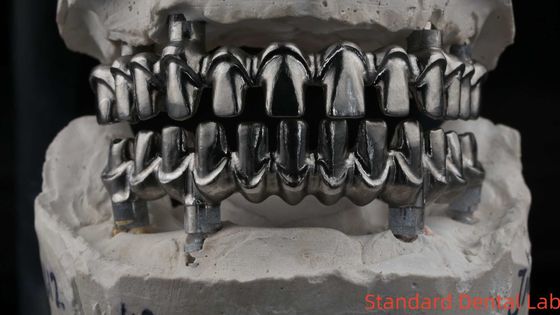 Diş Hekimi Hybird Malo İmplant Köprüsü Profesyonel Mükemmel Uyumlu FDA Sertifikalı