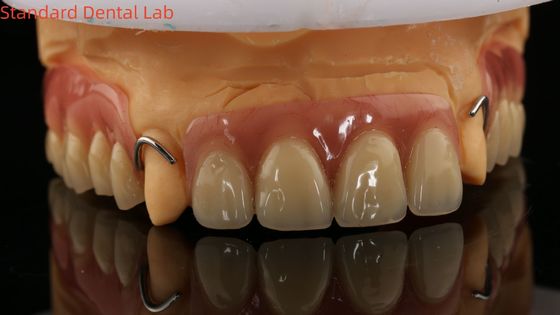 Sıcaklığı iyileştirilmiş Ivoclar Kısmi Akrilik Diş Dentüsü Diş Laboratuvarı 3B baskı modeli ile yüksek doğruluk
