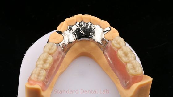 Metal Alaşımları Kobalt Krom Kısmi Diş Dişleri Ivoclar Scheftner Konforlu döküm metal çerçeve