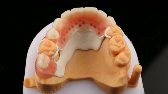 Peek Kısmi Çerçeve Tasarımı ISO CE ve FDA Diş Laboratuvarı Akrilik Kısmi Diş Dişleri Çerçeve