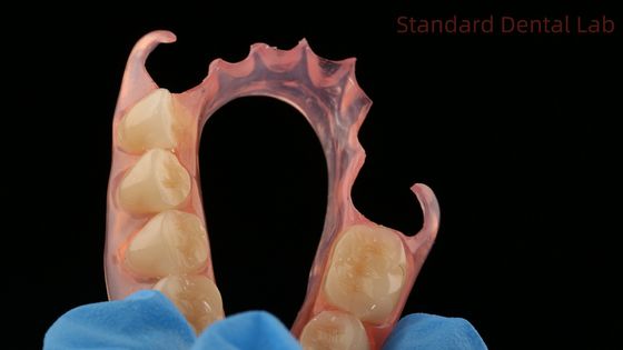 Diş TCS Valplast Esnek Kısmi Diş Dişleri Diş Laboratuvarı 3D Baskı Modeli Yüksek Estetik