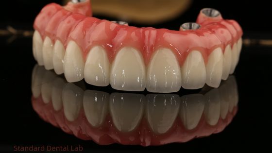 Tam kemerli zirkonya implantları köprü zirkonya taç vita gölge özel tüm dört / altı diş implantı