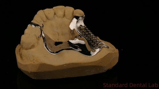 Yüksek Güçlü 3D Yazdırılmış Alçak Çerçeve COCR Kısmi Diş Dişleri Krom Kobalt Alçak Metal Çerçeve
