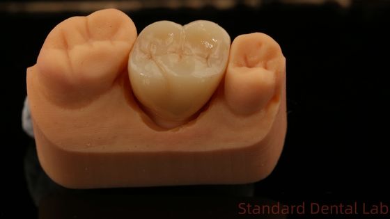 Dental Laboratuvarı, Çin. Hızlı teslimat.