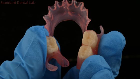 Diş TCS Valplast Esnek Kısmi Diş Dişleri Nesbit Valplast Finish Çin Diş Laboratuvarı Valplast Clap