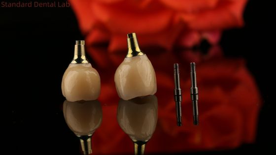 Porselen Zirkonya Çimento Geri Alınmış vida implant Özel Uyumlu Estetik için Altıgen Baş Şekli