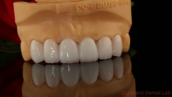 Tam Kontür Zirkonya tacı şeffaflığı 3D PRO Porselen örtümü yok Standart Diş Laboratuvarı
