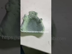 Hızlı ve dökme çerçeve diş hekimleri için Co-Cr metal kısmi diş protezi çerçevesi