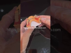 Yüksek estetik akrilik kısmi diş protezi açık kilitli ve akrilik dişlerle Çin Diş Laboratuvarı