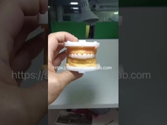 Yüksek Estetik BruxZir Tam Kontür Zirkonya Taçları PFZ Köprüsü