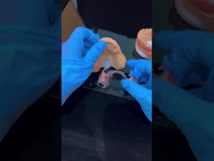 Açık çerçeve Akrilik Metal Kısmi Diş Dişleri Çerçeveleri Yüksek Estetik Çin diş laboratuarı