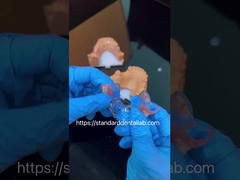 FDA Kobalt Chrome Yüksek Estetik Açık Çerçeve Kısmi