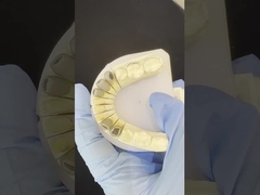 Metal dökme Post Core Crown Cocr Tam Retentive Tam Zirkonya Bruxier