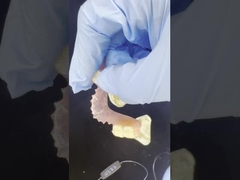 Doğal konfor ve estetik kalitesi için esnek Valplast dişleri